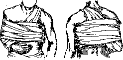 Clavicle: figure 9 from the 1928–1936 encyclopedia article