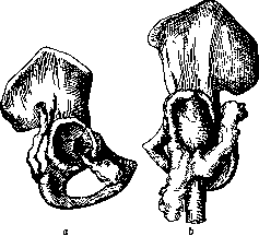 Pertussis: figure 18 from the 1928–1936 encyclopedia article