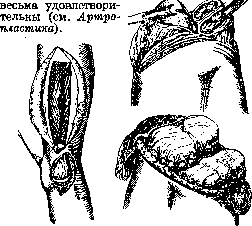 Knee Joint: figure 7 from the 1928–1936 encyclopedia article