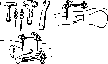 Bone Suture: figure 4 from the 1928–1936 encyclopedia article