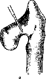 Bone: figure 17 from the 1928–1936 encyclopedia article