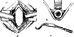 Bone: figure 13 from the 1928–1936 encyclopedia article
