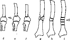 Bone: figure 18 from the 1928–1936 encyclopedia article