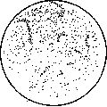 Rat Typhoid: figure 1 from the 1928–1936 encyclopedia article