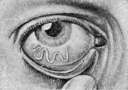 Lymphogranulomatosis: figure 2 from the 1928–1936 encyclopedia article