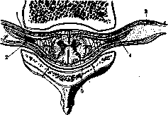 Laminectomy: figure 3 from the 1928–1936 encyclopedia article