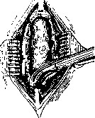 Laminectomy: figure 2 from the 1928–1936 encyclopedia article