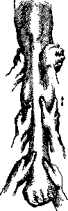 Massage: figure 9 from the 1928–1936 encyclopedia article