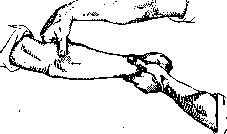 Massage: figure 3 from the 1928–1936 encyclopedia article
