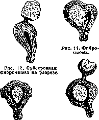 Uterus: figure 14 from the 1928–1936 encyclopedia article