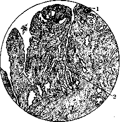 Uterus: figure 10 from the 1928–1936 encyclopedia article