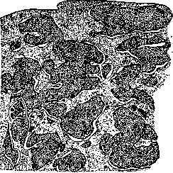 Uterus: figure 18 from the 1928–1936 encyclopedia article