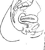 Uterine Rings: figure 3 from the 1928–1936 encyclopedia article