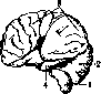 Cerebellopontine Angle: figure 15 from the 1928–1936 encyclopedia article