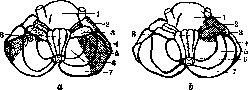 Cerebellopontine Angle: figure 25 from the 1928–1936 encyclopedia article