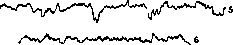 Electrical Currents of the Brain: figure 2 from the 1928–1936 encyclopedia article
