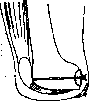 Sabaneev Operation: figure 2 from the 1928–1936 encyclopedia article