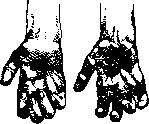 Rudolphi, Karl Asmund / Hand: figure 2 from the 1928–1936 encyclopedia article