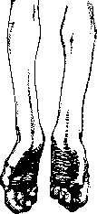 Rudolphi, Karl Asmund / Hand: figure 1 from the 1928–1936 encyclopedia article
