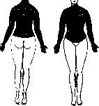 Syringomyelia: figure 3 from the 1928–1936 encyclopedia article