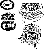 Sexual Sterilization: figure 5 from the 1928–1936 encyclopedia article