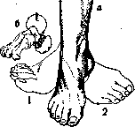 Foot: figure 8 from the 1928–1936 encyclopedia article
