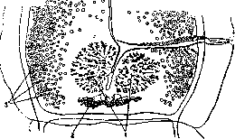 Taeniasis and Taeniarhynchosis: figure 5 from the 1928–1936 encyclopedia article