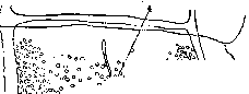 Taeniasis and Taeniarhynchosis: figure 4 from the 1928–1936 encyclopedia article