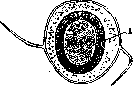 Taeniasis and Taeniarhynchosis: figure 8 from the 1928–1936 encyclopedia article