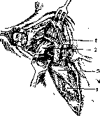 Thoracoplasty: figure 16 from the 1928–1936 encyclopedia article