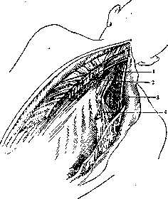 Thoracoplasty: figure 12 from the 1928–1936 encyclopedia article