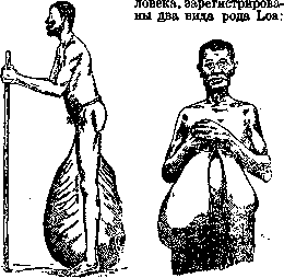 Filariae: figure 2 from the 1928–1936 encyclopedia article