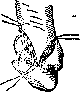 Finger: figure 1 from the 1928–1936 encyclopedia article