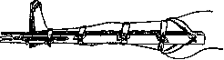 Splints: figure 12 from the 1928–1936 encyclopedia article