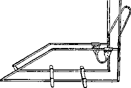 Splints: figure 18 from the 1928–1936 encyclopedia article