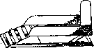Splints: figure 7 from the 1928–1936 encyclopedia article