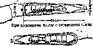 Splints: figure 23 from the 1928–1936 encyclopedia article
