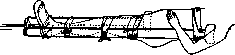 Splints: figure 13 from the 1928–1936 encyclopedia article