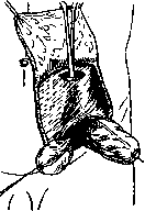 Anus: figure 6 from the 1928–1936 encyclopedia article