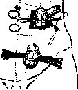 Anus: figure 4 from the 1928–1936 encyclopedia article