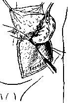 Anus: figure 7 from the 1928–1936 encyclopedia article