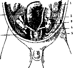 Gubernaculum Hunteri: figure 1 from the 1928–1936 encyclopedia article