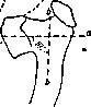 Varus: figure 1 from the 1928–1936 encyclopedia article