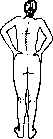Scoliosis: figure 6 from the 1928–1936 encyclopedia article