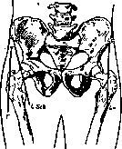 Arthrotomy: figure 1 from the 1928–1936 encyclopedia article