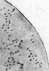Tularemia: figure 2 from the 1928–1936 encyclopedia article