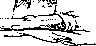 Kernig's Sign: figure 1 from the 1928–1936 encyclopedia article