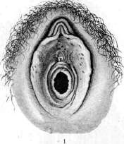 Hymen: figure 1 from the 1928–1936 encyclopedia article