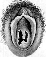 Hymen: figure 3 from the 1928–1936 encyclopedia article