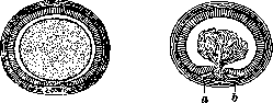 Coloboma: figure 3 from the 1928–1936 encyclopedia article